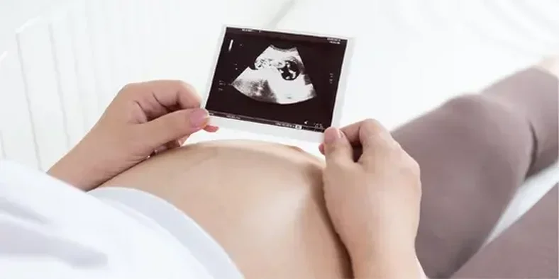 Ibu hamil memegang hasil foto USG
