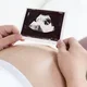 Ibu hamil memegang hasil foto USG