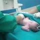Bayi Tidak Menangis Saat Lahir, Benarkah Tidak Normal?