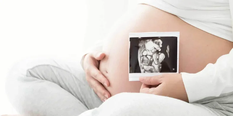 Ibu hamil memegang foto USG